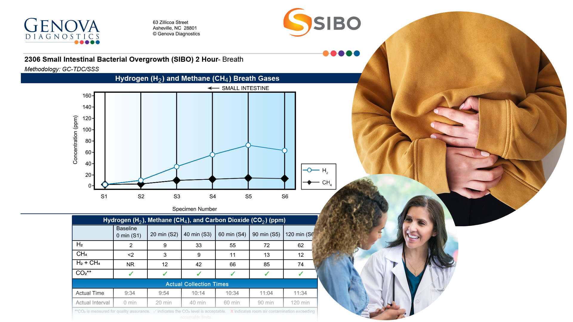 sibo report-people